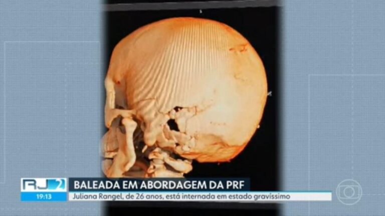 Estudante baleada pela PRF tem leve melhora, mas quadro segue gravíssimo, diz hospital | Rio de Janeiro Estudante baleada pela PRF tem leve melhora, mas quadro segue gravíssimo, diz hospital | Rio de Janeiro